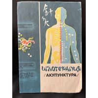 Иглотерапия (акупунктура)