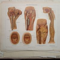 HALSKRANKHEITEN. Литография Германия. Гравюра середина 19века 30x24см. РАСПРОДАЖА КОЛЛЕКЦИИ.